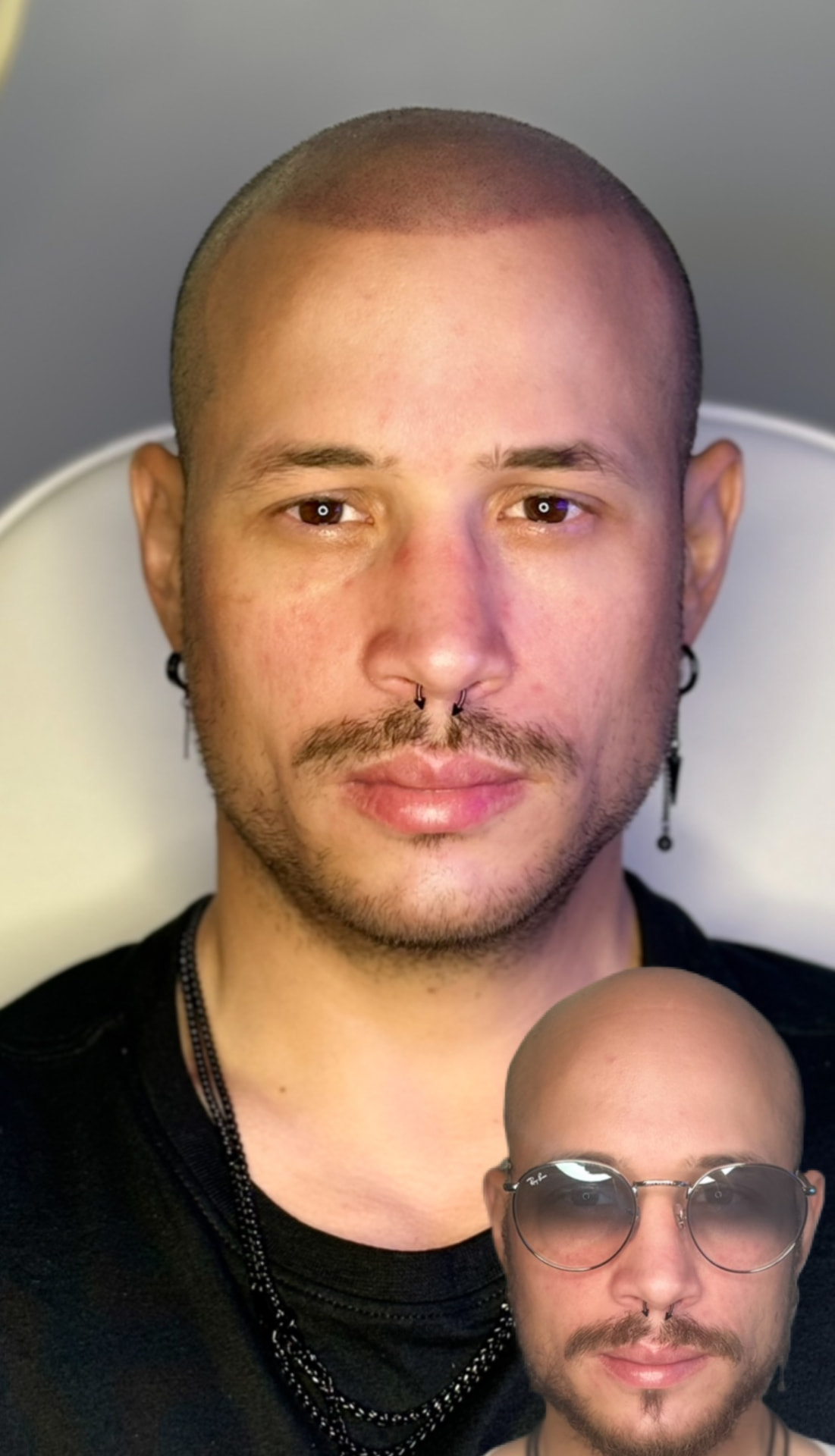 Soft feathered hairline on a shaved head