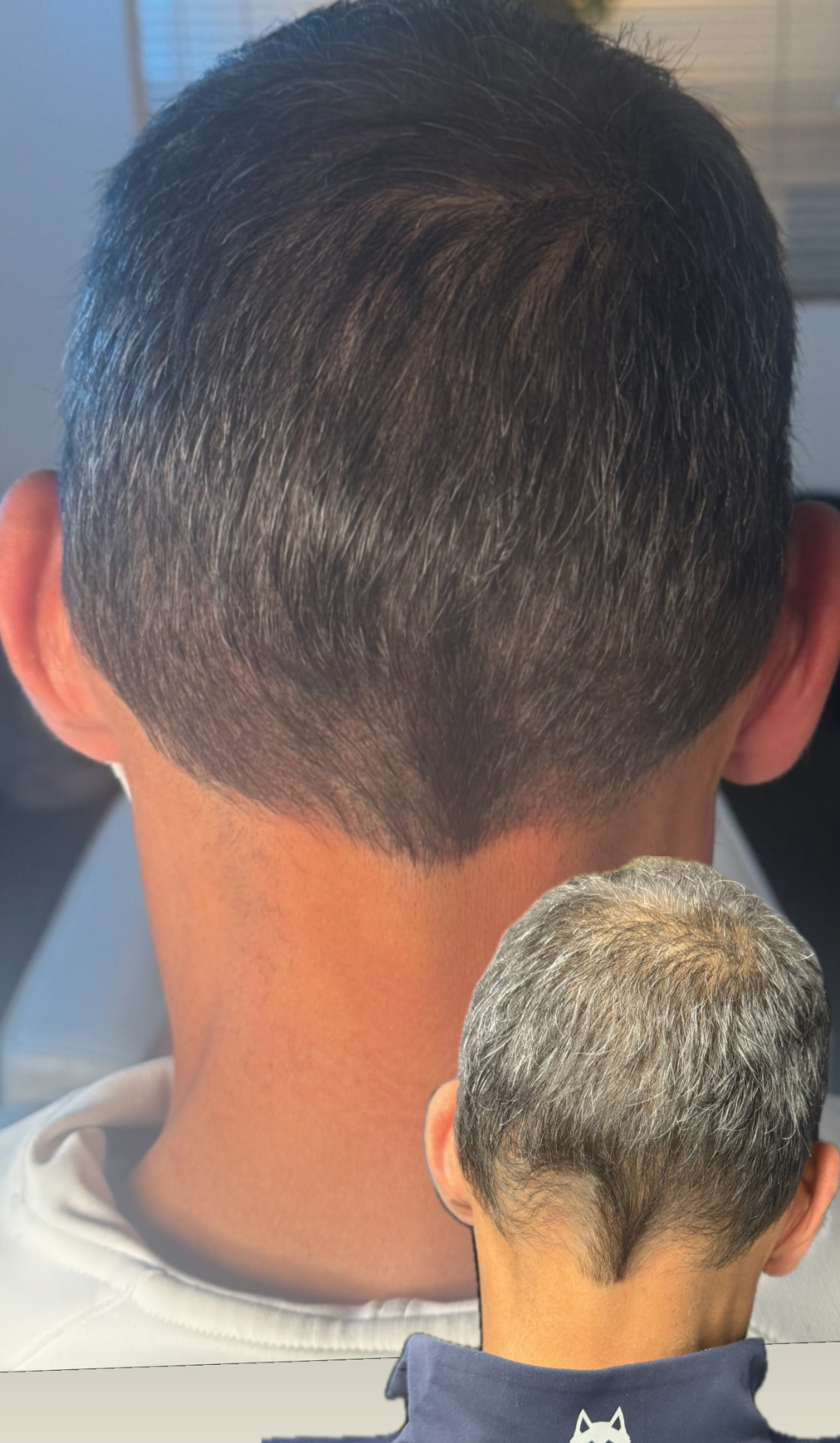 Nape and crown density blend from behind
