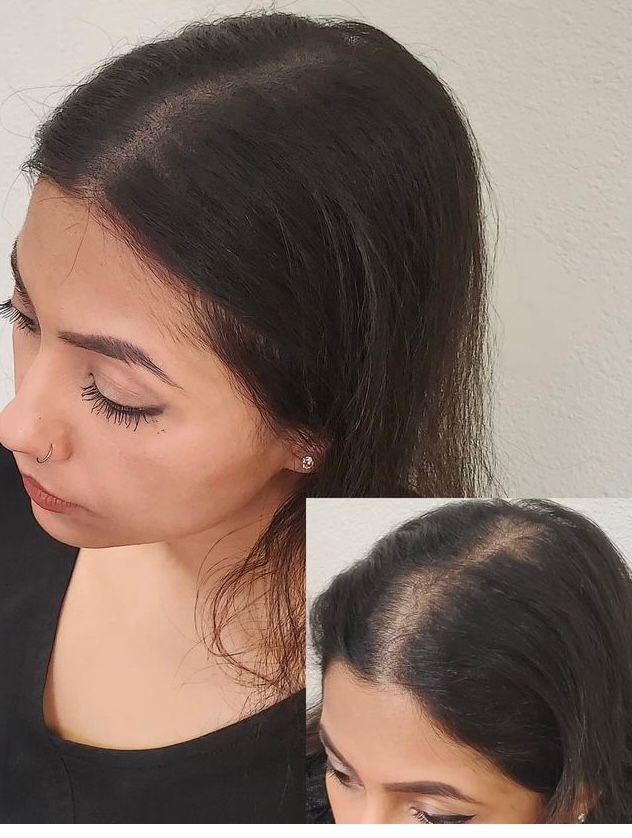 Density work through the part line for a female client